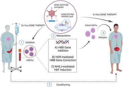 Genome editing for sickle cell disease: still time to correct?